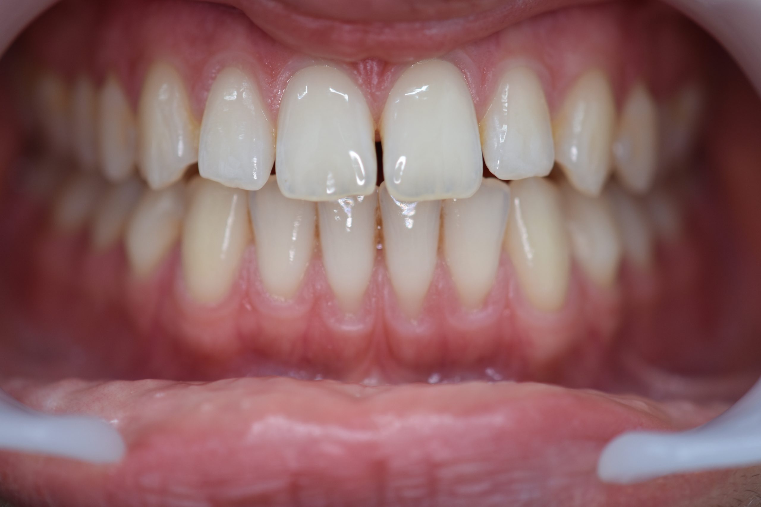 Ariana Zadran before