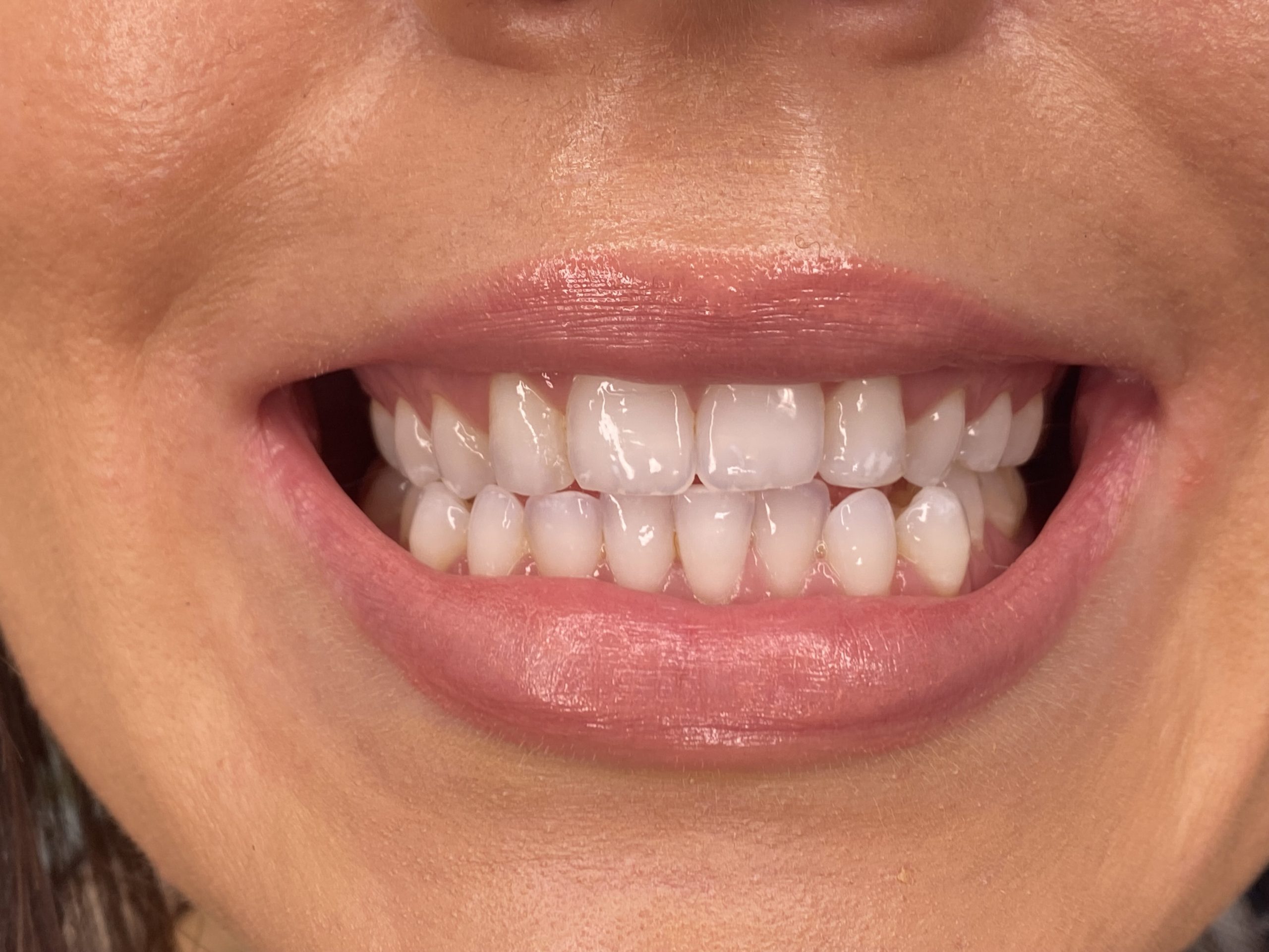 Siobhan Morgan after