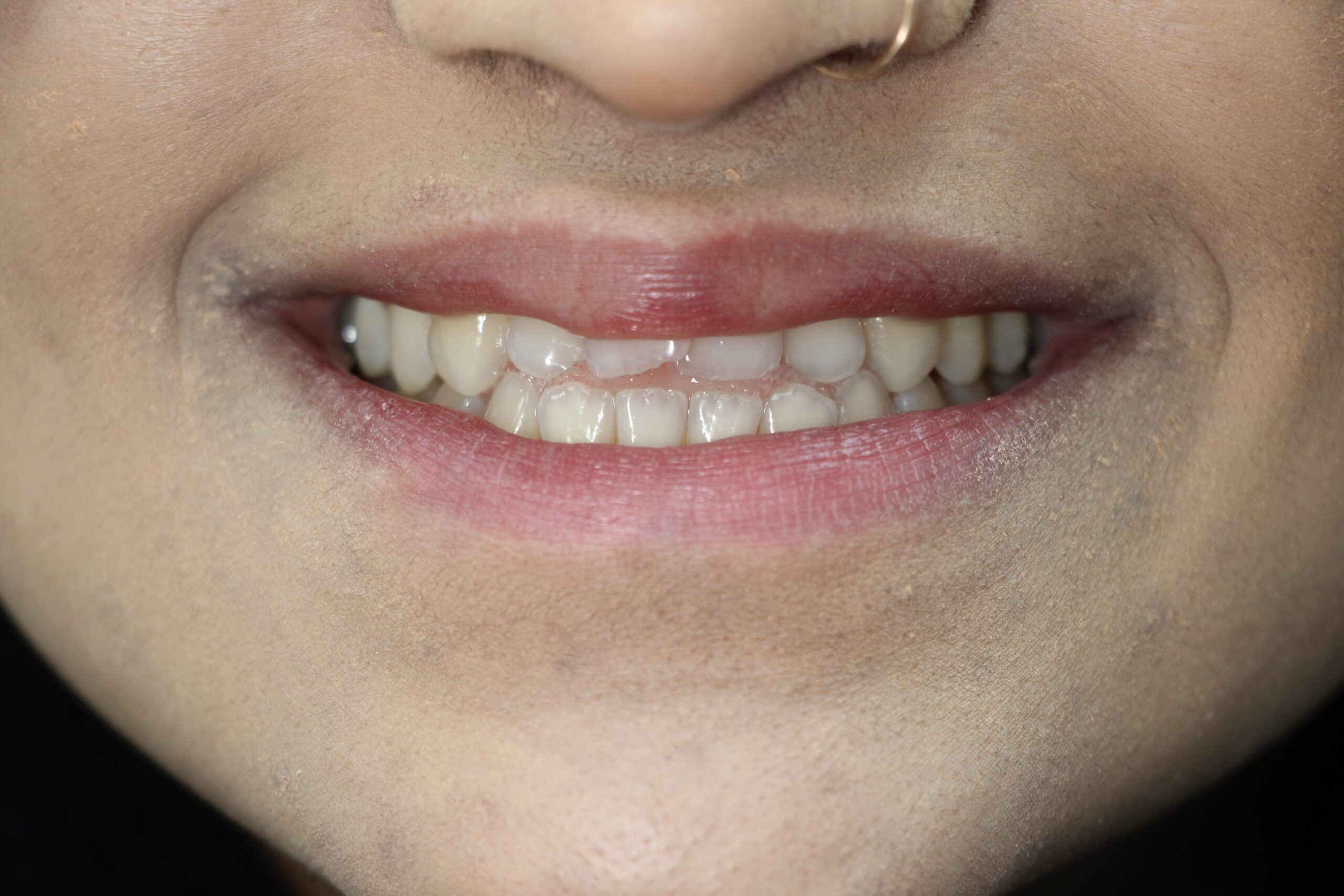 AS before-min AS before-min