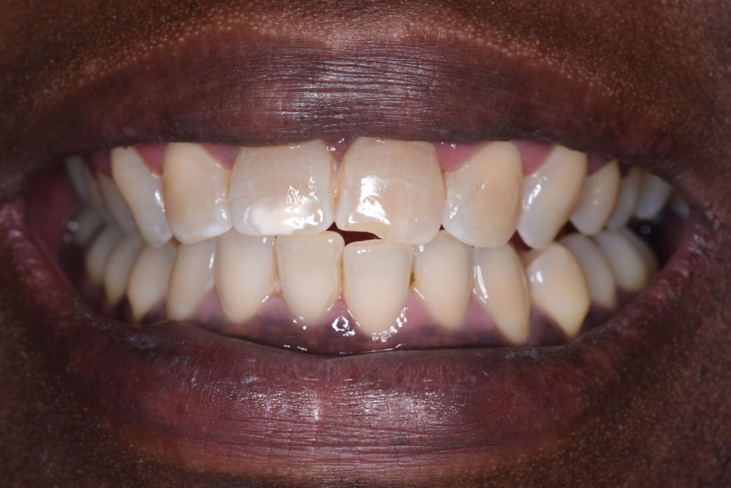 JF before1-min JF before1-min